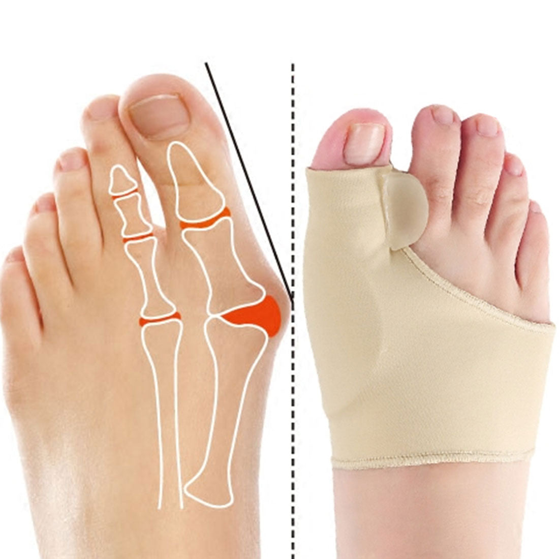 Silicone thumb valgus corrector big foot bone toe valgus toe separator toe separator correction sleeve